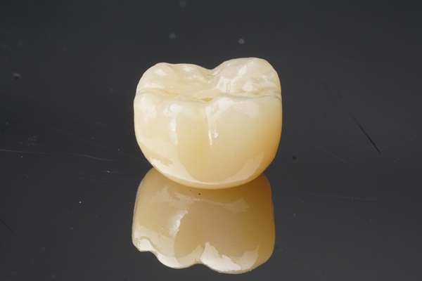 What Materials Are Dental Crowns Made Of?